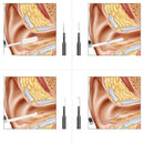 Live Ear Medicinal ear endoscope.