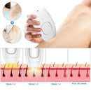 Belleza PRO - IPL Laser Hair Removal Device 